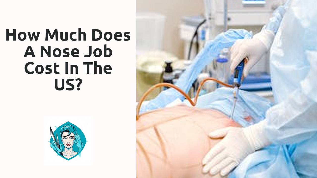 How much does a nose job cost in the US?